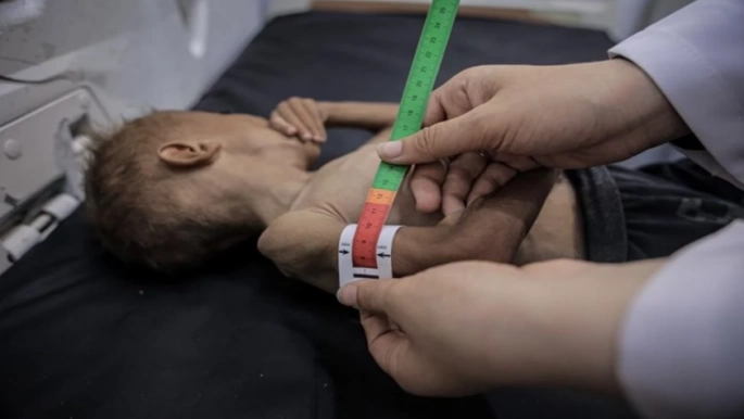Gazze'de son 24 saatte 1'i çocuk 6 kişi daha açlıktan hayatını kaybetti